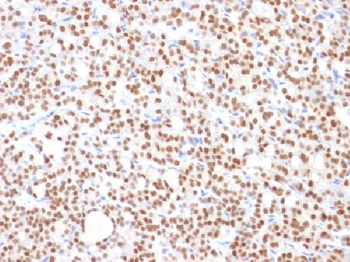 Anti-PAX8 (Renal Cell Marker) Antibody