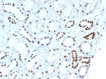 PAX8 (Renal Cell Marker) Antibody