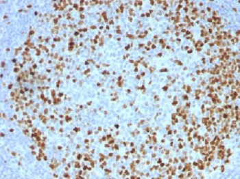 Topoisomerase II alpha Antibody