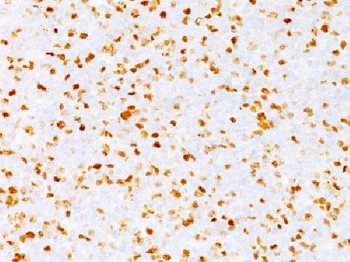 Topoisomerase II alpha Antibody