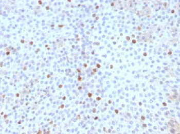 Topoisomerase II alpha Antibody