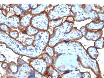 CD71 / Transferrin Receptor (TFRC) (Extracellular Domain) Antibody