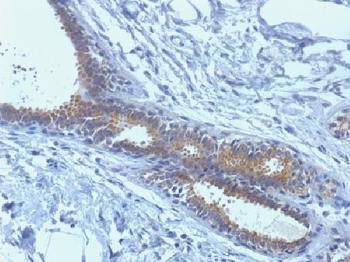 BRCA1 Antibody