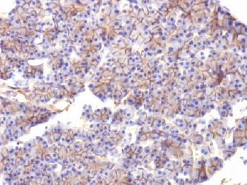 Spectrin beta III (SPTBN2) Antibody