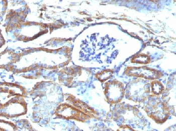Spectrin beta III (SPTBN2) Antibody