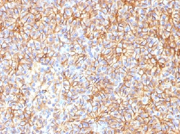 Spectrin beta III (SPTBN2) Antibody