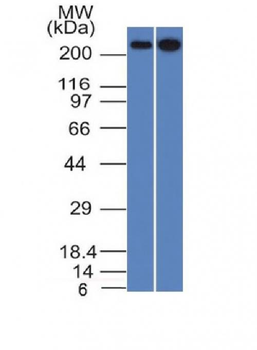 Spectrin beta III (SPTBN2) Antibody