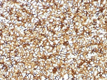 Spectrin beta III (SPTBN2) Antibody