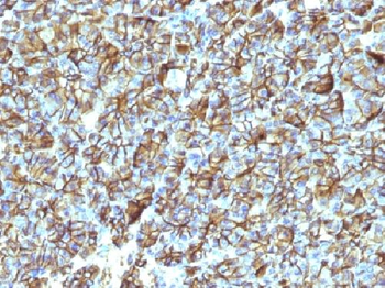 Spectrin beta III (SPTBN2) Antibody