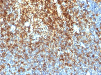 CD43 (T-Cell Marker) Antibody