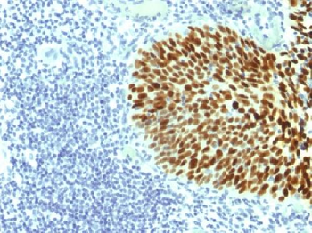 SOX2 (Transcription Factor) Antibody