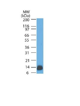 Anti-S100B Antibody
