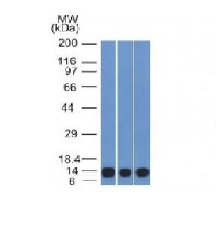 Anti-S100A4 Antibody