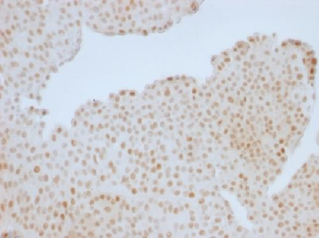 Rb1 (Tumor Suppressor Protein) Antibody