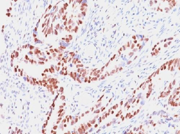 Rb1 (Tumor Suppressor Protein) Antibody