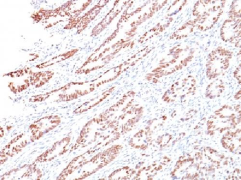 Rb1 (Tumor Suppressor Protein) Antibody