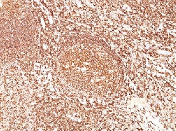 CD45 / LCA (B-Cell Marker) Antibody