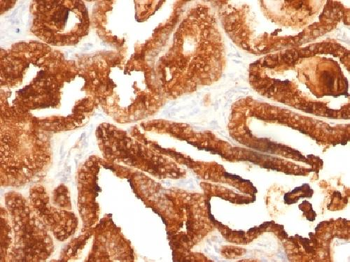 Prostate Specific Acid Phosphatase (PSAP) Antibody