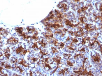 Anti-MAML3 Antibody