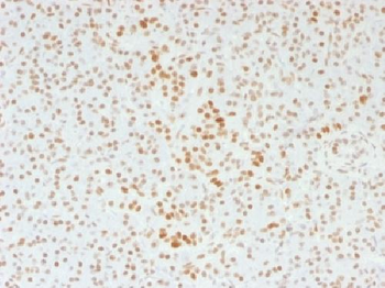 ATRX / RAD54 Antibody