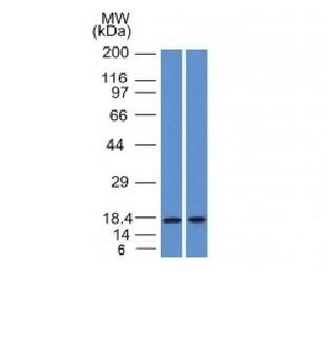 GCDFP-15 Antibody