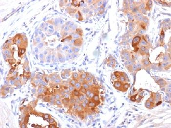 GCDFP-15 Antibody