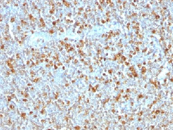 Alpha-1-Antitrypsin (SERPINA1) Antibody