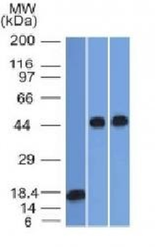 Anti-Alpha-1-Antitrypsin (SERPINA1) Antibody