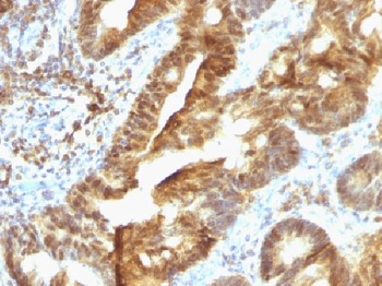 TDP2 / EAPII Antibody