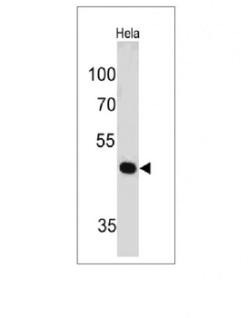 PAX7 (Rhabdomyosarcoma Marker) Antibody