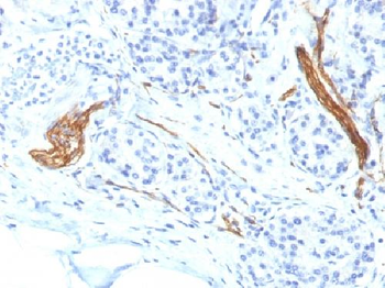 CD56 / NCAM1 / NKH1 (Neuronal Cell Marker) Antibody
