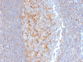 Anti-MRP1 / ABCC1 Antibody