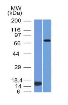 MMP2 / Collagenase Type IV A Antibody