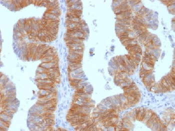 Ep-CAM / CD326 (Extracellular Domain) Antibody