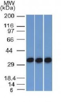Ep-CAM / CD326 (Extracellular Domain) Antibody