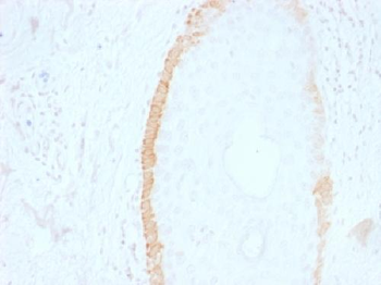 Cytokeratin 15 (KRT15) (Basal Cell Marker) Antibody