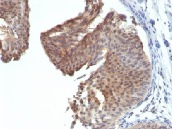 Cytokeratin 6 (KRT6) Antibody