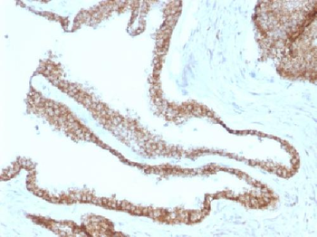 Catenin, gamma Antibody