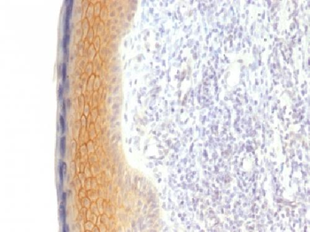 Catenin, gamma Antibody