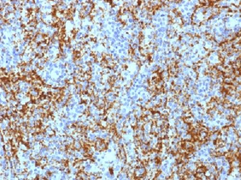 CD61 / Integrin beta-3 / Platelet Glycoprotein IIIa Antibody