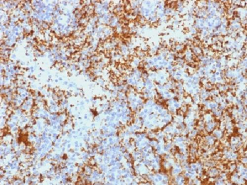 CD61 / Integrin beta-3 / Platelet Glycoprotein IIIa Antibody