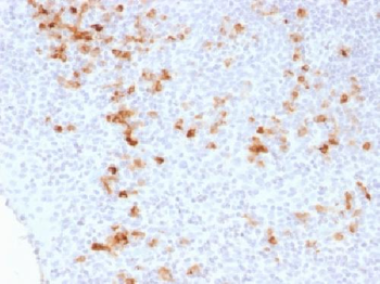 Kappa Light Chain (B-Cell Marker) Antibody