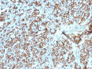 Anti-HLA-DP/-DQ/-DR (MHC II) Antibody
