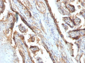 Galectin-13 (GAL13) / Placental Protein 13 (PP13) Antibody