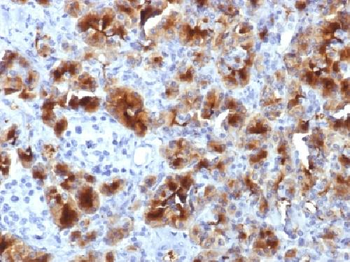GP2 (Glycoprotein 2) / ZAP75 Antibody