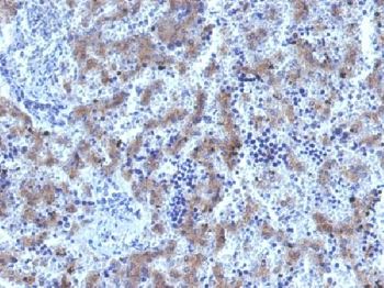 Glypican-3 (GPC3) (Hepatocellular Carcinoma Marker) Antibody