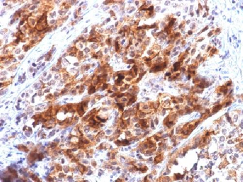 Glypican-3 (GPC3) (Hepatocellular Carcinoma Marker) Antibody