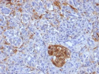 Ferritin, Light Chain (FTL) (Microglia Marker) Antibody