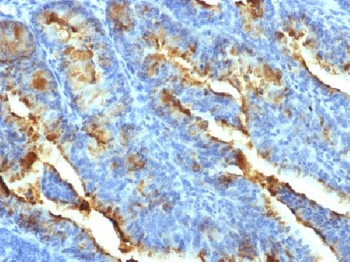 FSH-Receptor (Ovarian Marker) Antibody