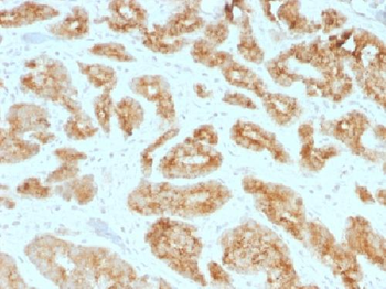 AMACR / p504S (Prostate Cancer Marker) Antibody
